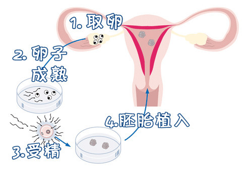 试管借卵代怀机构